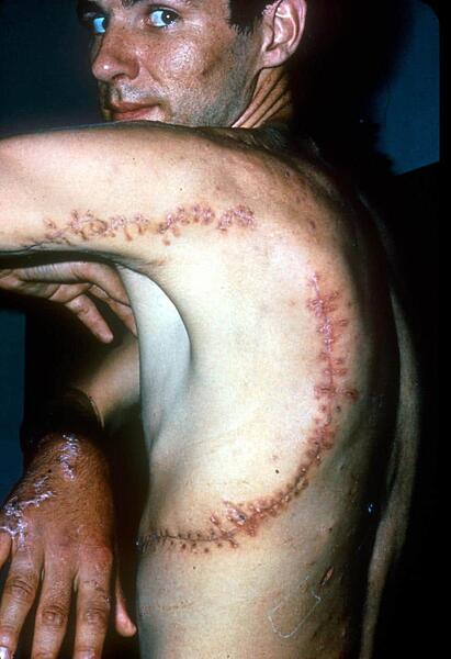 Rodney_Scar_008_lg-155059836