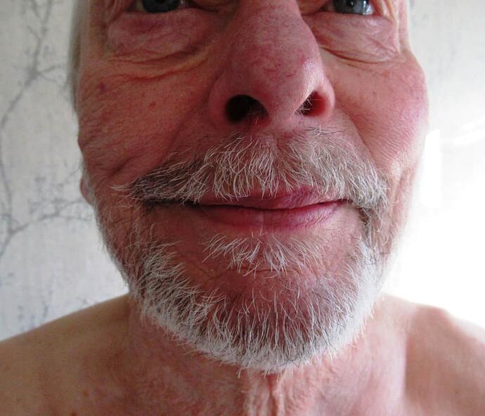 Bobs Beard 040225